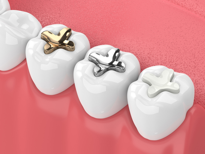 Metal Free Dentistry